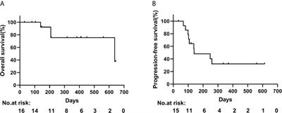 Safety of PD-1/PD-L1 Inhibitors Combined With Palliative Radiotherapy and Anti-Angiogenic Therapy in Advanced Hepatocellular Carcinoma